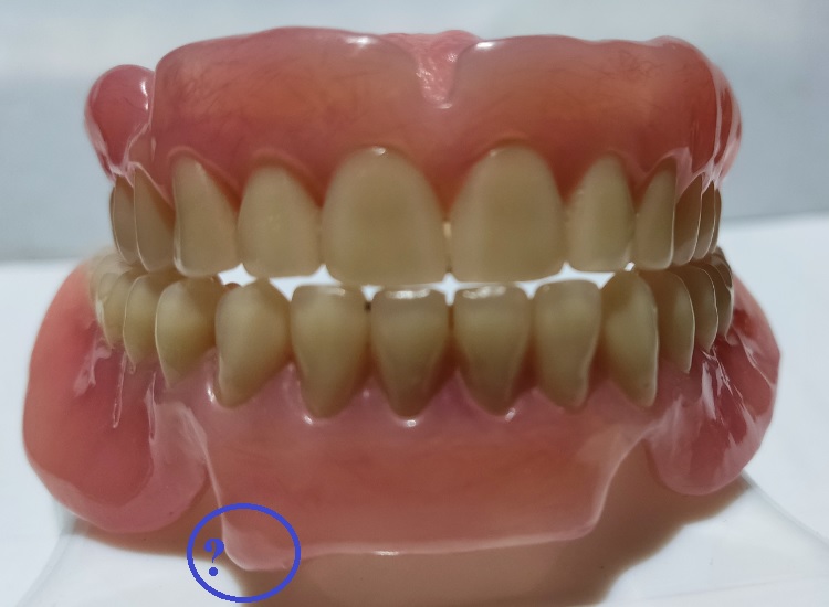 dentures-nausea-rework-full-front-view.jpg